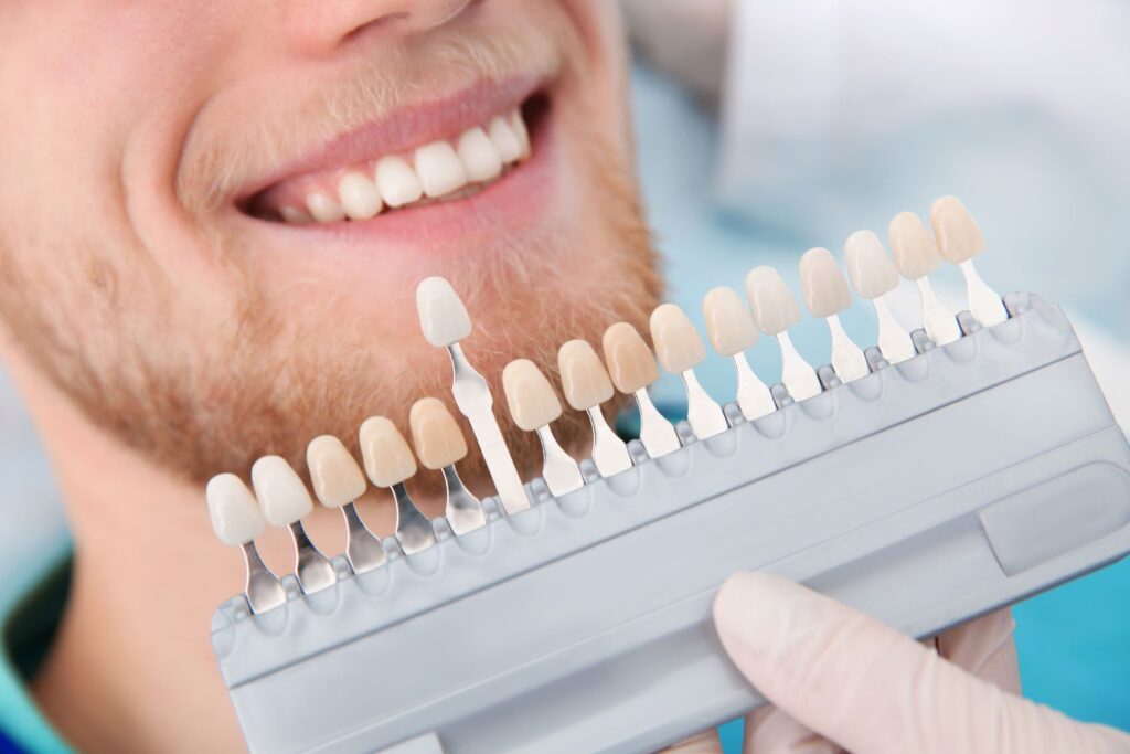 Valkoitset hampaat SAV erämaksu